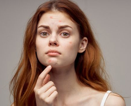 Netskincare